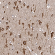 NBP1-90294 - NCEH1 / AADACL1